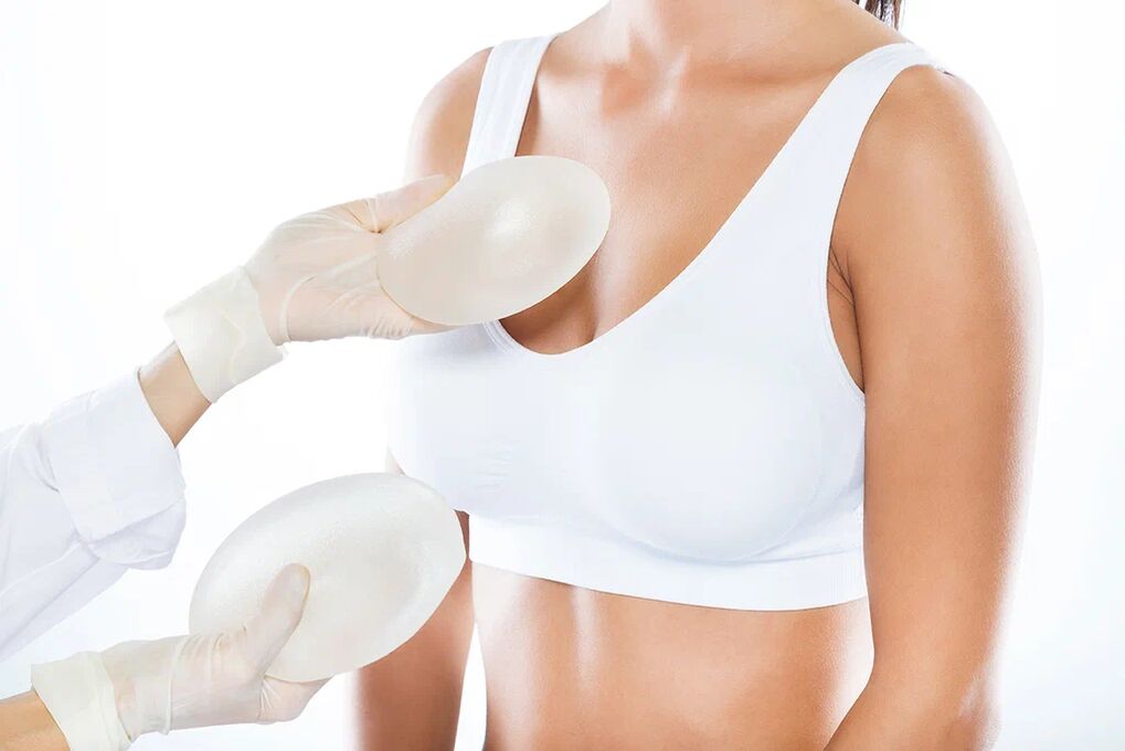 Selección de implantes antes de la cirugía de aumento mamario. 